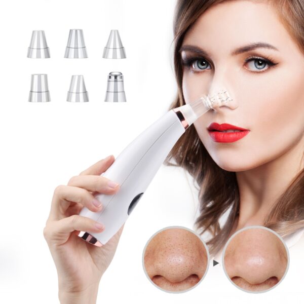 Vacuum Facial Blackhead Remover and Pore Cleanser