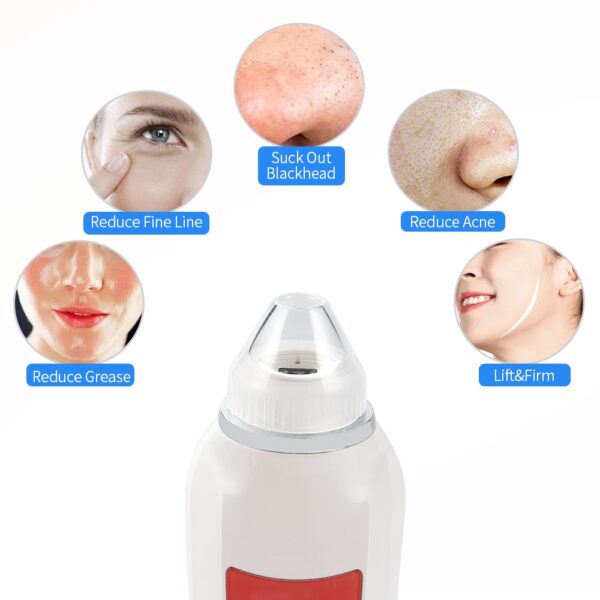 USB Rechargeable Blackhead Remover Vacuum - Image 7