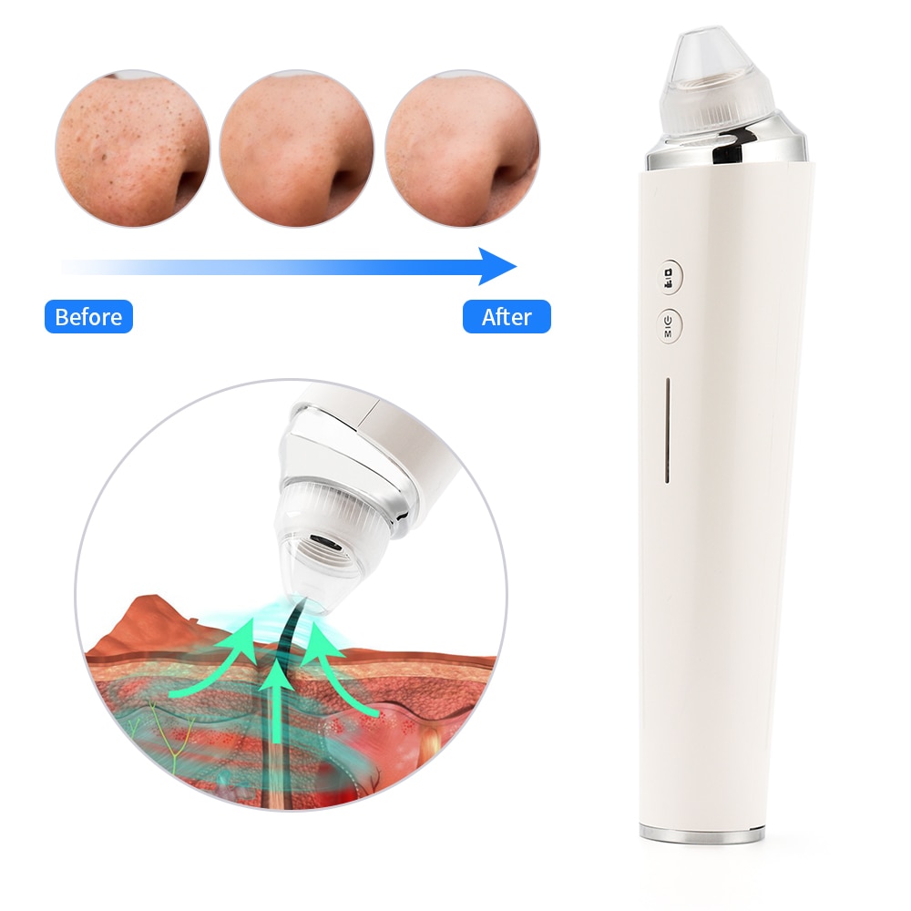 USB Rechargeable Blackhead Remover Vacuum