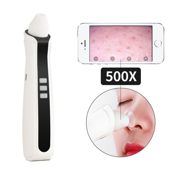 USB Rechargeable Blackhead Remover Vacuum - Image 3