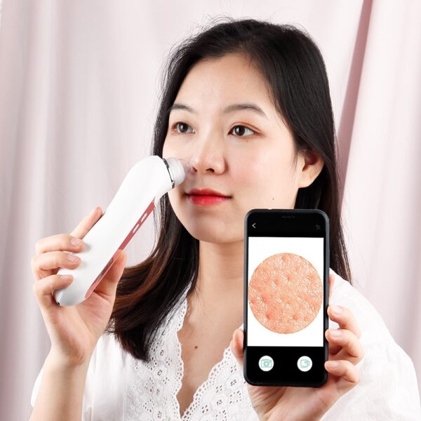 USB Rechargeable Blackhead Remover Vacuum - Image 8