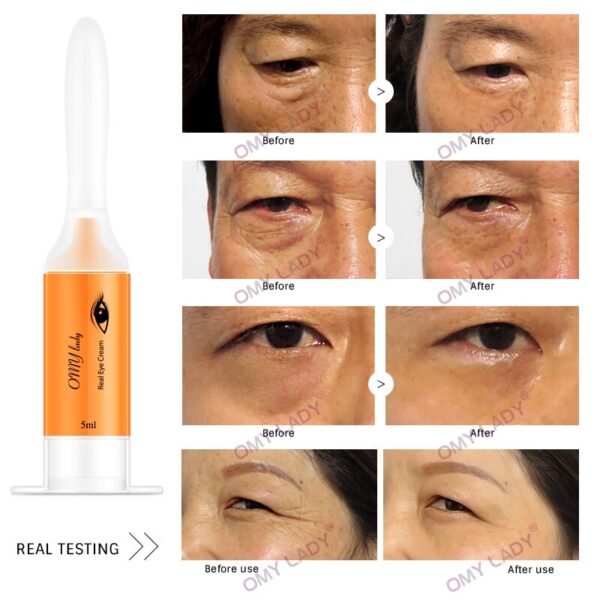 Eye Cream Instant Removing Eyebags - Image 4