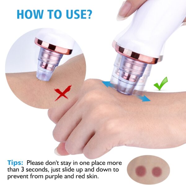 Blackhead Removing Vacuum Tool - Image 5