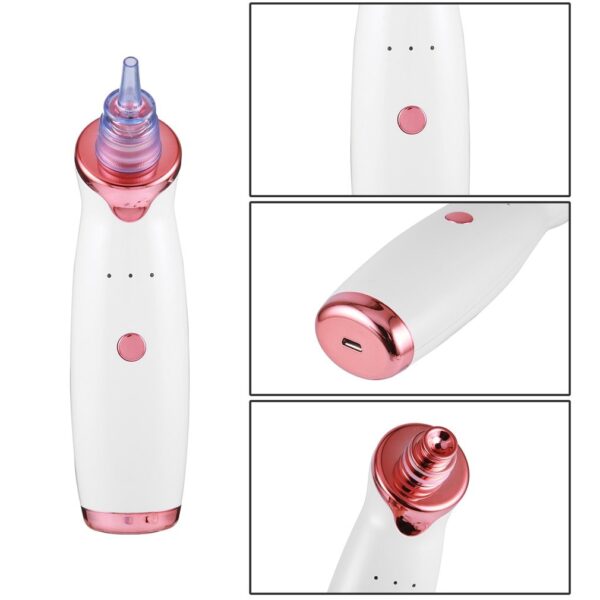 Rechargeable Vacuum Blackhead Remover - Image 4