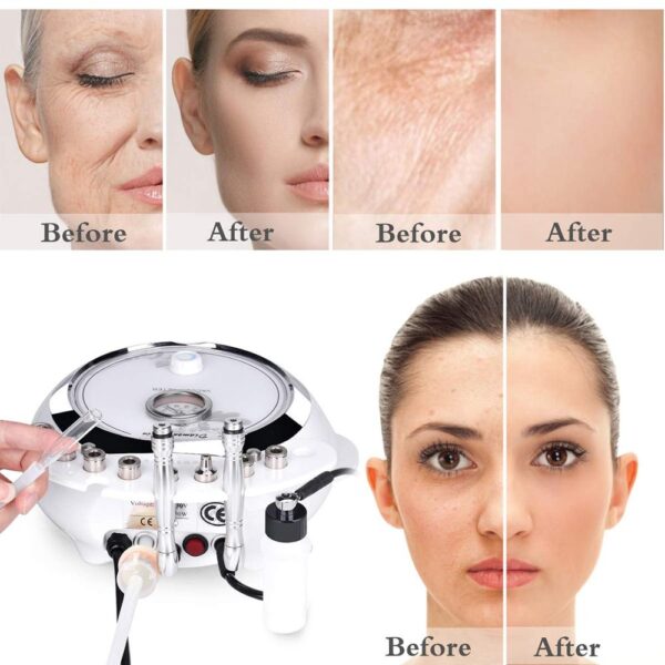 Professional Diamond Microdermabrasion Machine for Home Using - Image 4